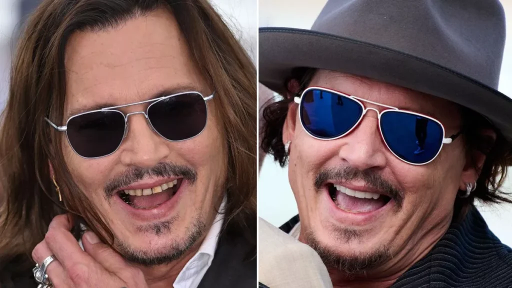 Johnny Depp teeth change